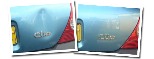 Dent Removal Hertfordshire